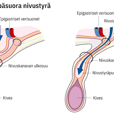 Vatsanpeitteiden tyrät – milloin ja miten leikata?