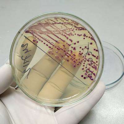 ESBL-Escherichia coli -infektiot vähenivät pandemiavuosina